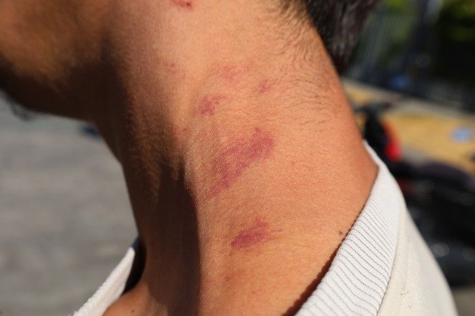 ضربوشتم و بازداشت به دلیل گوش دادن به موسیقی کردی در استانبول/ پلیس: "شما تروریست هستید"