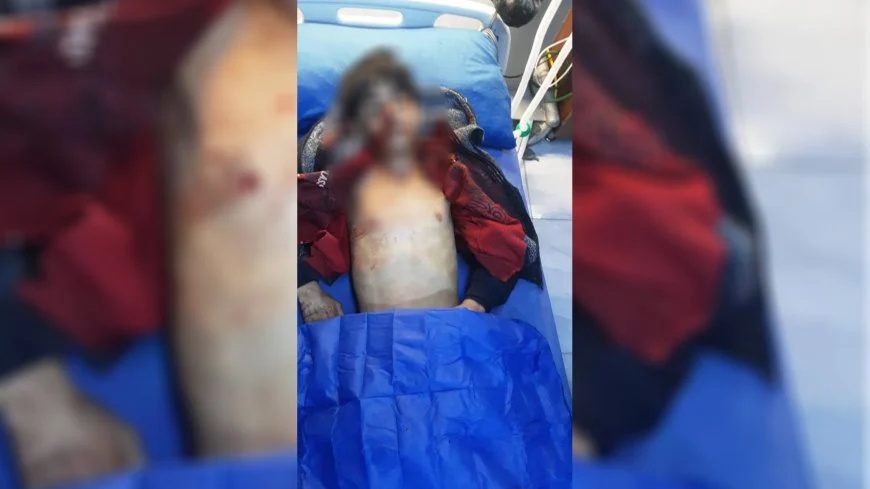تشدید درگیریها در محلههای کُردنشین حلب؛ دستکم ۷ کشته و ۴۶ زخمی