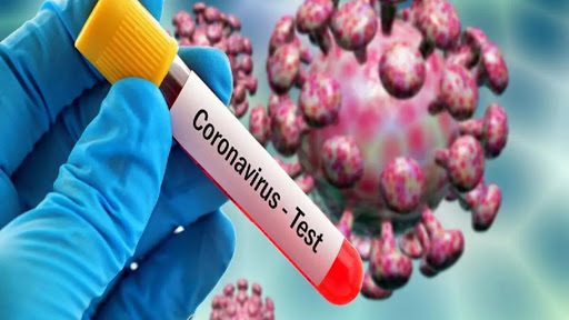 گزارش ۹ مورد ابتلای جدید کرونا در استان ایلام