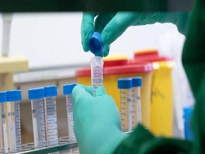 اهدای پلاسمای بیمار بهبود یافته کووید 19 در آذربایجان غربی برای نخستین بار