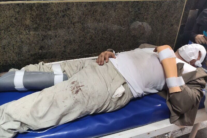 متعرضان به طبیعت این بار ماموران یگان حفاظت دیواندره را زخمی کردند