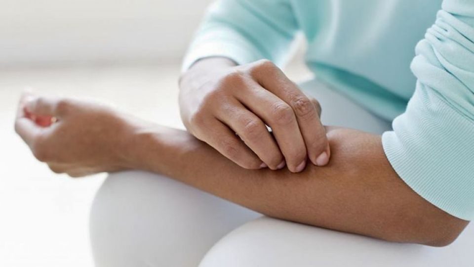 خارش پوست، جدیدترین نشانه ابتلا به کرونا