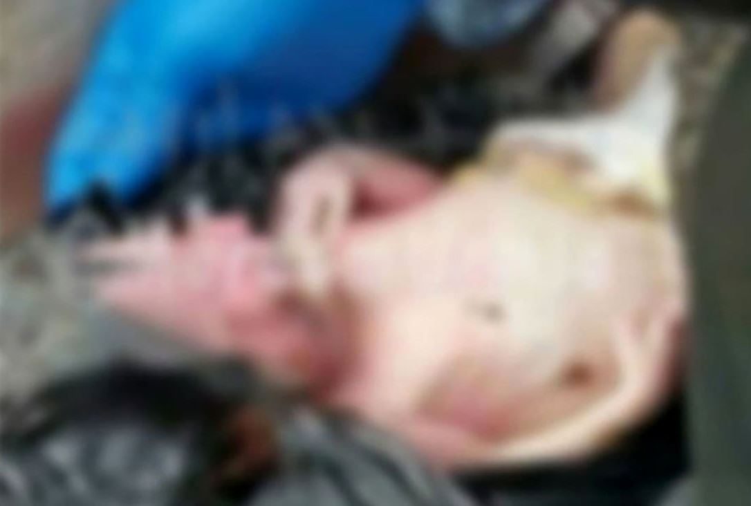 کشف جسد یک نوزاد هفت ماهه در اورمیه داخل کیسه زباله