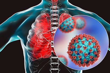 رکورد بستری بیماران سندرم حاد تفسی آذربایجان غربی در ٢ ماه اخیر شکسته شد