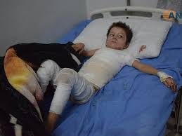 Turkey use of chemical weapons proves its defeat: officials