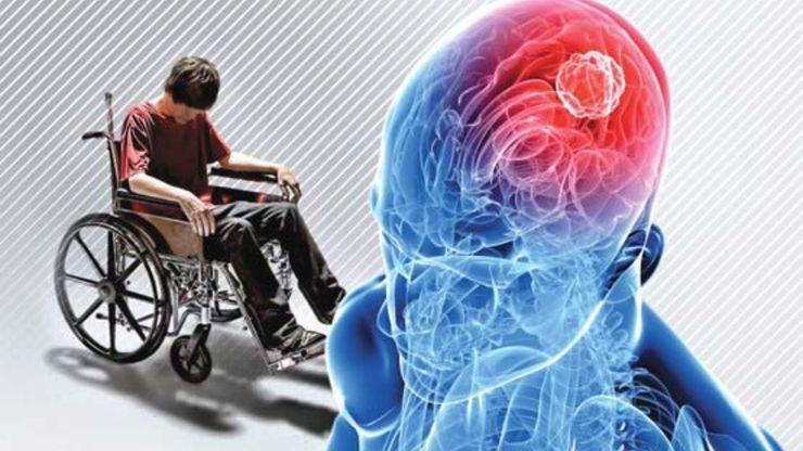 حمایت بهزیستی ایلام از ۱۴۷ بیمار مبتلا به ام.اس