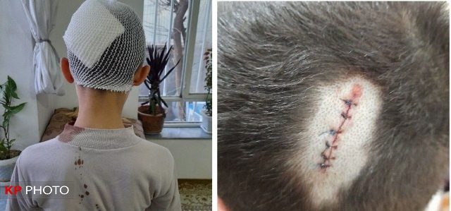 معلم خاطی در اشنویه سر یک دانش آموز را شکست!
