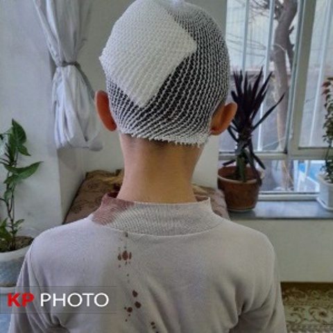 ضرب و شتم دانش آموز ابتدایی در اشنویه با جدیت پیگیری می شود