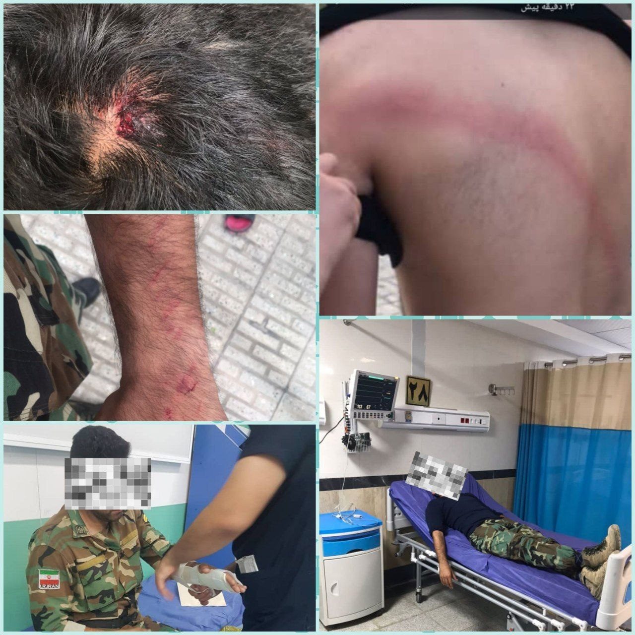 ضرب و شتم جنگلبانان در چوار / ضاربین دستگیر شدند