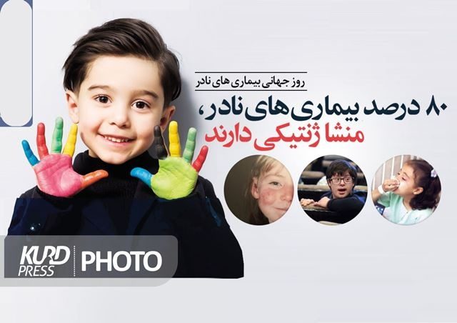 80 درصد از بیماریهای نادر ژنتیکی اند