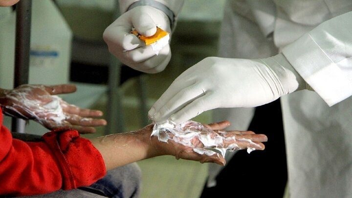 شمار مصدومان چهارشنبه سوری در آذربایجان غربی به ٣٨٦ نفر رسید