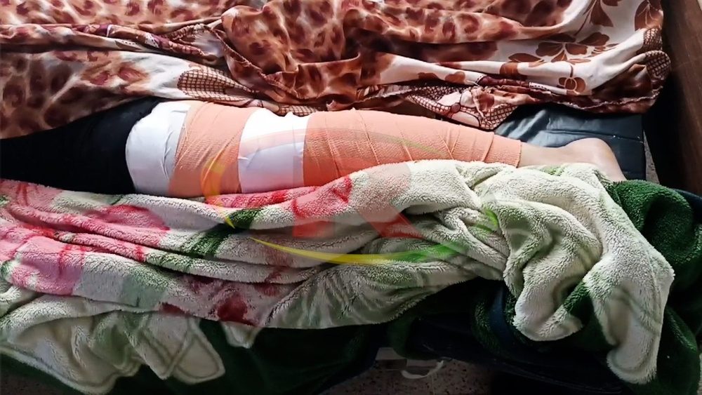 کشته و زخمی شدن ۶ تن در حملات امروز ترکیه به منبج
