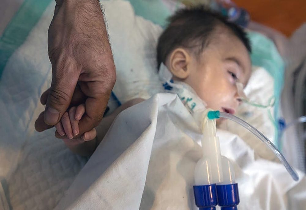 ۹ بیمار مبتلا به آتروفی عضلانی نخاعی در کردستان شناسایی شدند