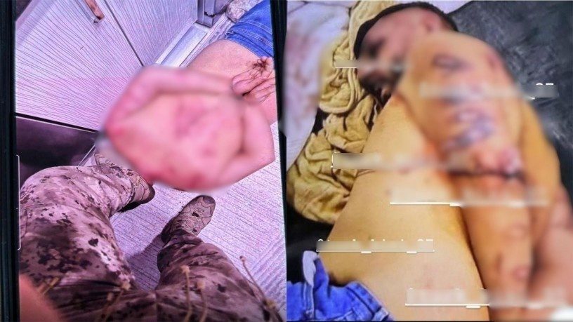 انتشار تصاویر جدید از شکنجه متهم پرونده چکمه کوی؛ خانواده آچیک خواستار رسیدگی قضایی شدند
